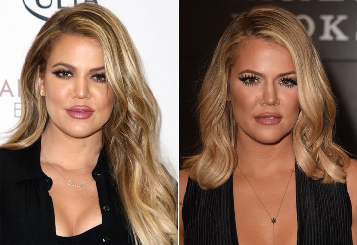 Khloé Kardashian