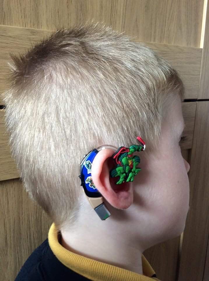 Mom Creates Superhero Hearing Aids For Son