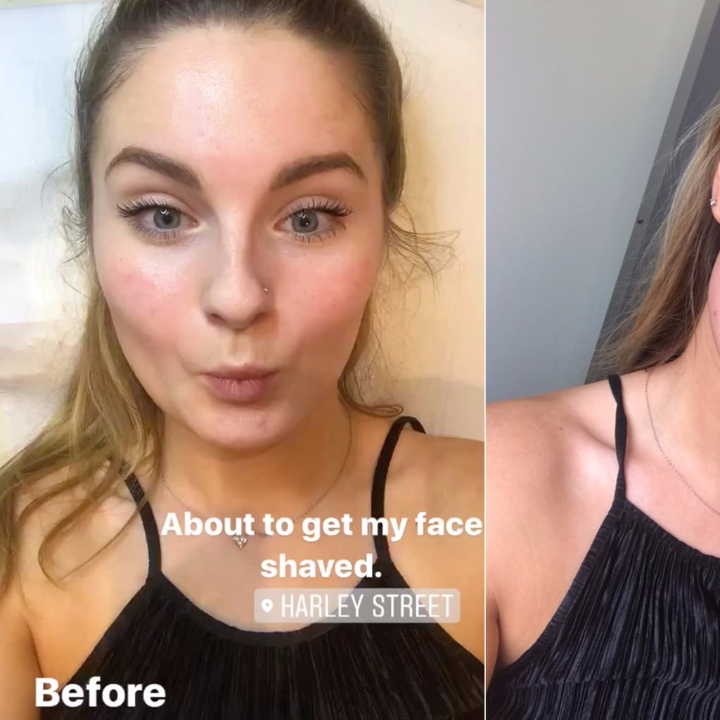 Facial Hair POPSUGAR Love Sex