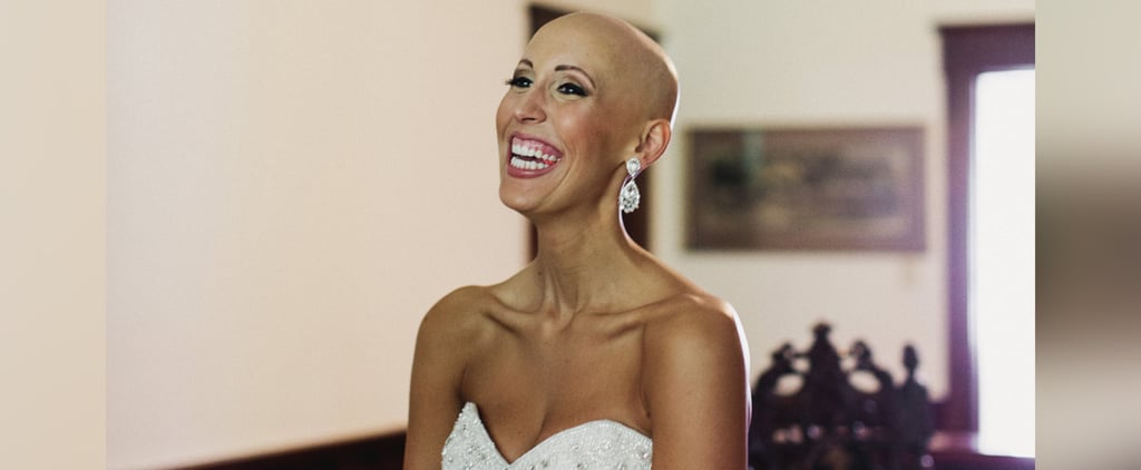 Bald Bride's Wedding Photos (Video)
