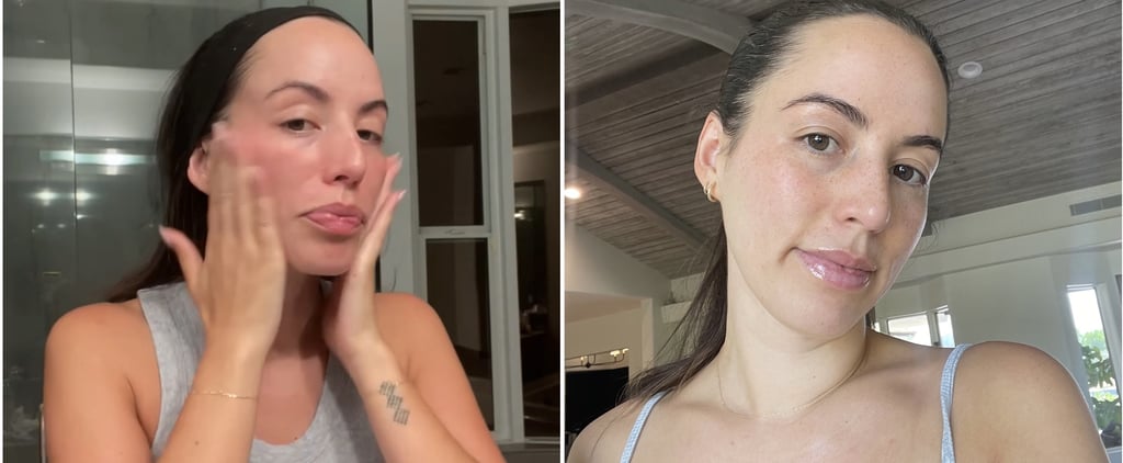I Tried "Skin Cycling" on My Acne-Prone Skin