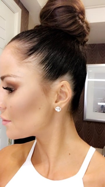 Miss USA Contestant Sarah Mousseau's Struggle With Alopecia