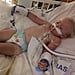 Toddler With Rocky Mountain Spotted Fever