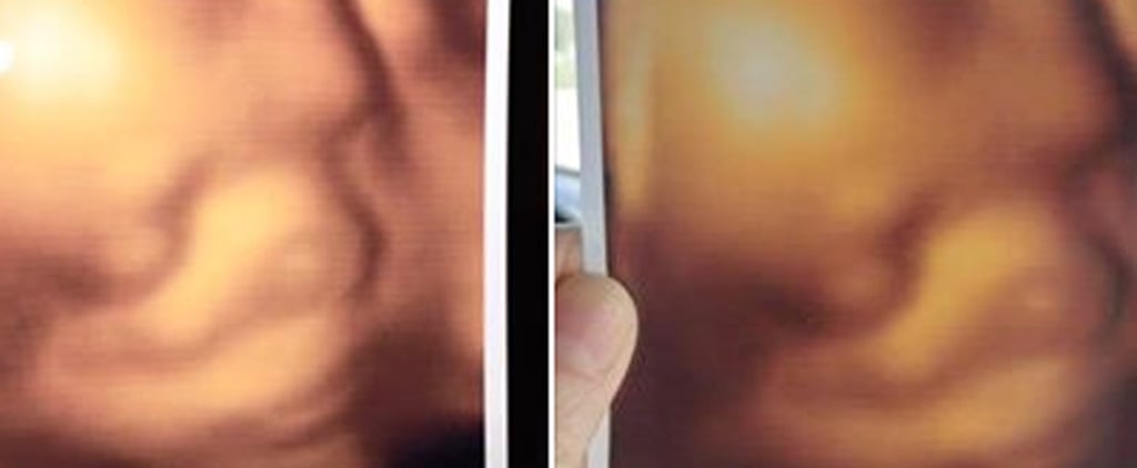 3d Ultrasound Clinic Scam Gives Parents Identical Photos