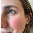 You Have to See the Results of This Blurring Eye Cream to Believe It