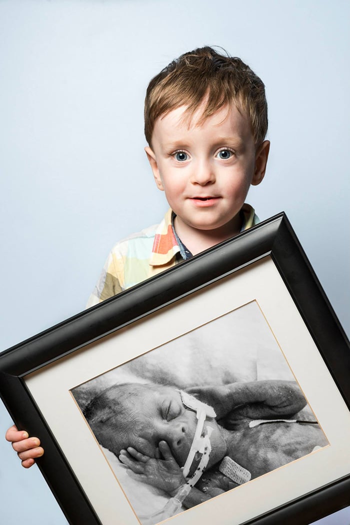 Felix Born At 24 Weeks These Then And Now Photos Of Premature Babies Prove How Resilient Preemies Really Are Popsugar Family Photo 26