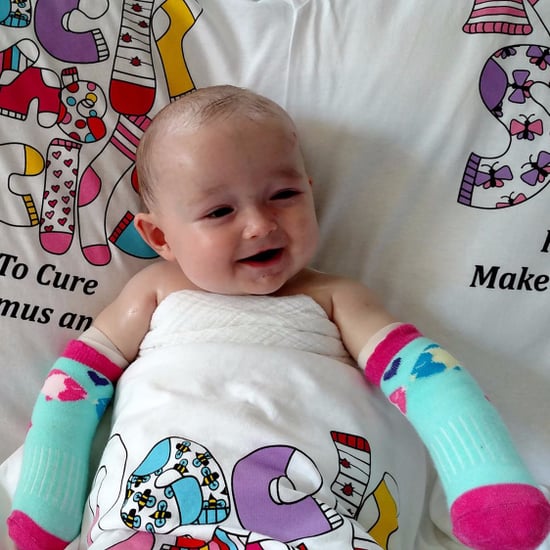 Parents Raise Awareness For Daughter's Rare Skin Disease