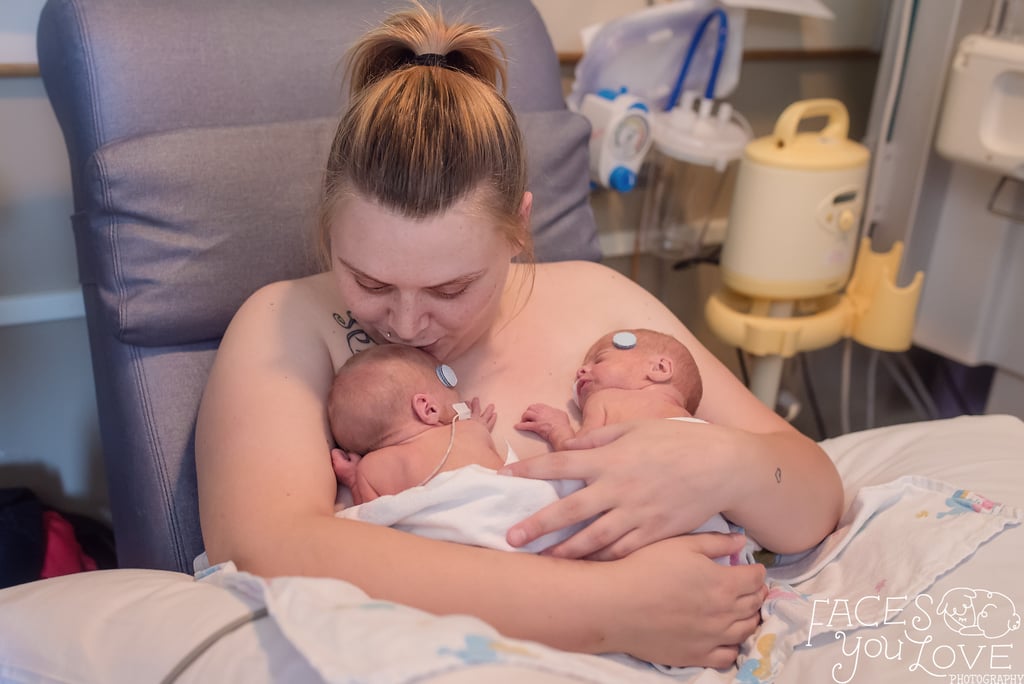 Moms Skin-to-Skin Bonding With Their Newborns in the NICU