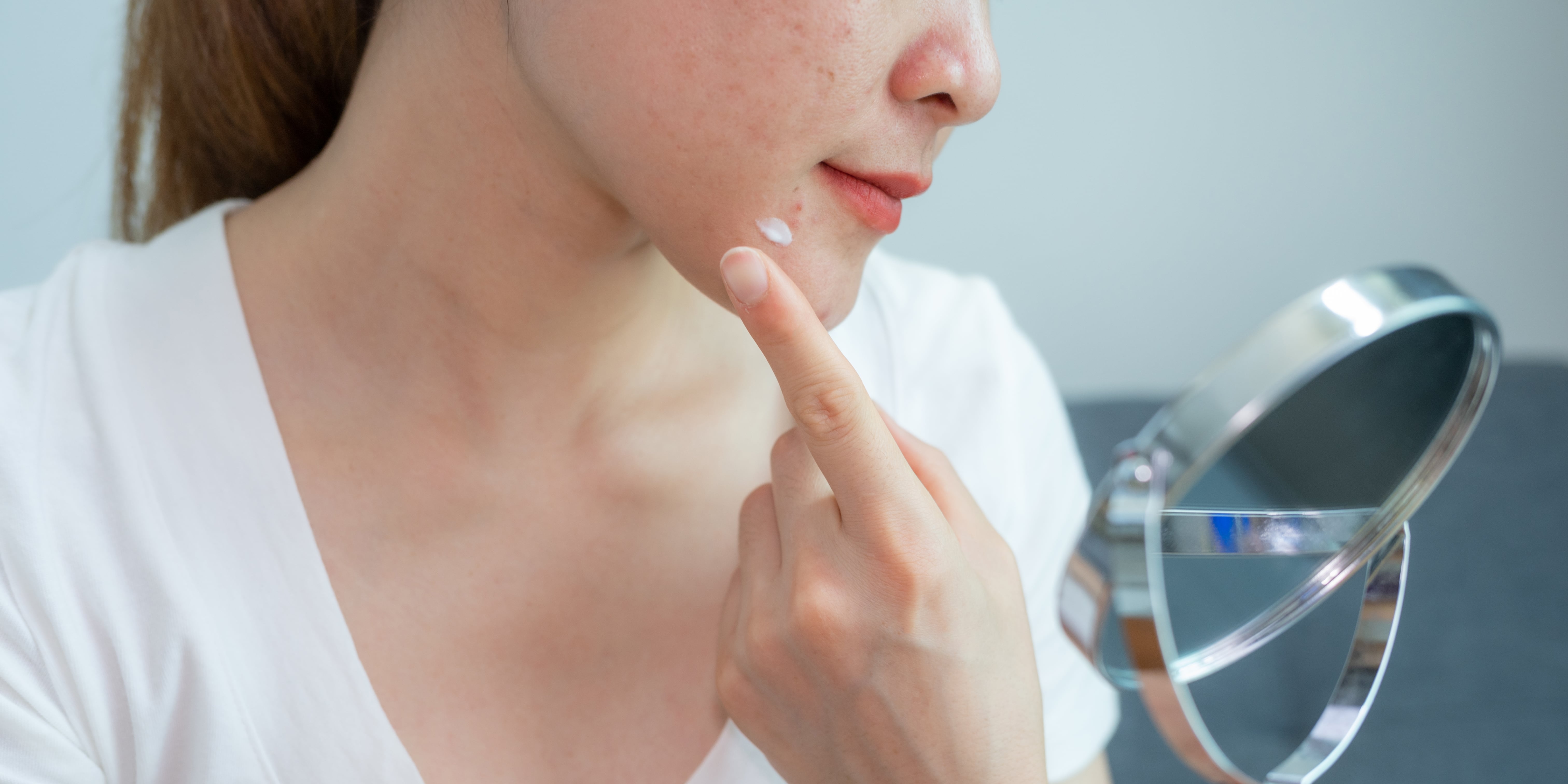 Hormonal Acne Causes and Treatments | POPSUGAR Beauty - Vimarsana News