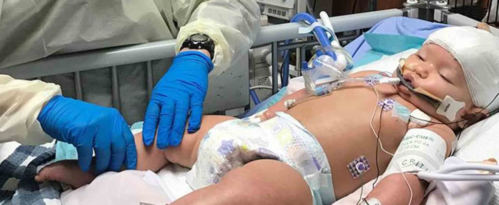 Baby in Coma After Catching RSV