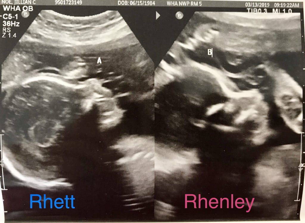 With her sister's support, Jill agreed to do another round of IVF, and this time it worked. Jill is officially carrying her sister's set of twins — who the Bliesners named Rhett and Rhenley — and talk about everything coming full circle.
"Our relationship has always been so strong, but I do believe this has brought us closer together," said Jill. "We talk even more throughout the day, which I didn't think could be possible. It has brought our tight-knit family even closer. Everyone is just so involved . . . it's just been fun to go through this experience with our entire family." 
So far, Jill's pregnancy has been going well, and naturally, Whitney has been by her side every step of the way. "I have been going to all the appointments with Jill and I love it," she explained. "It's the closest I can get to having the babies actually inside me! She has been amazing with it and I am just so very proud of her and how she has gone about this for me." 
Jill is expected to give birth via C-section on June 6. We couldn't be happier for this growing family!