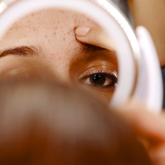 Best Whiteheads Treatments of 2024