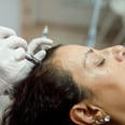 Does Microneedling Help With Hair Loss? Experts Weigh In