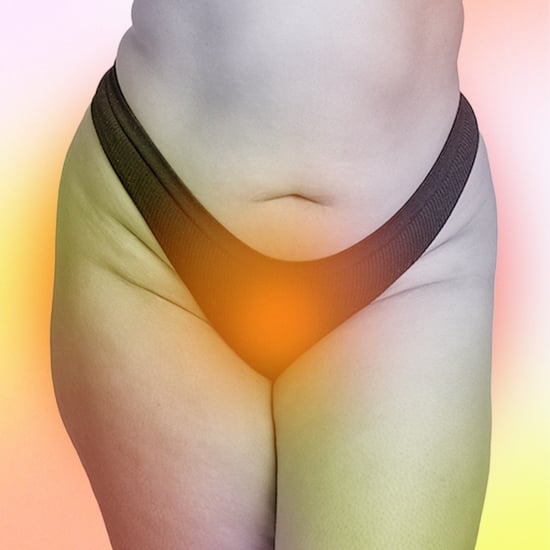 Latinas Are More Prone to Bacterial Vaginosis