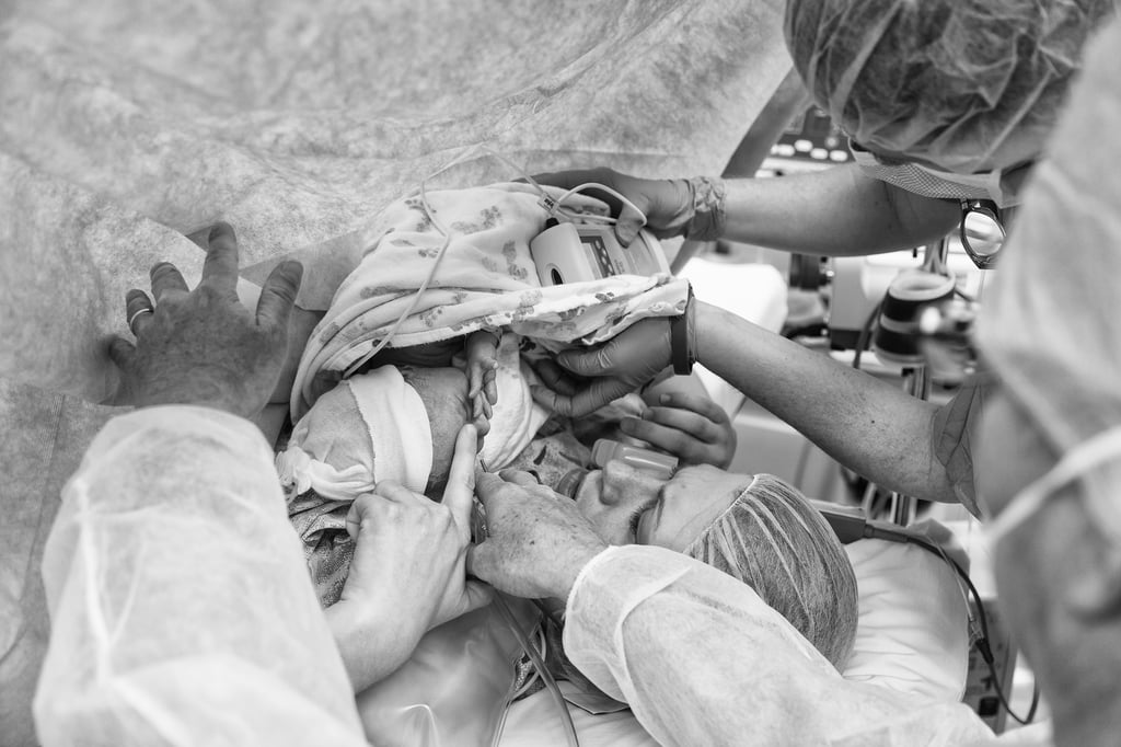 Photos of C-Sections
