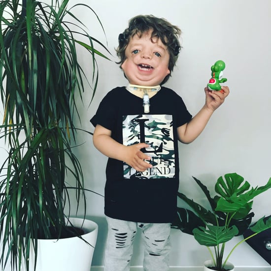 Baby Model With Facial Deformity