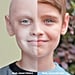 Childhood Cancer Survivor Photos