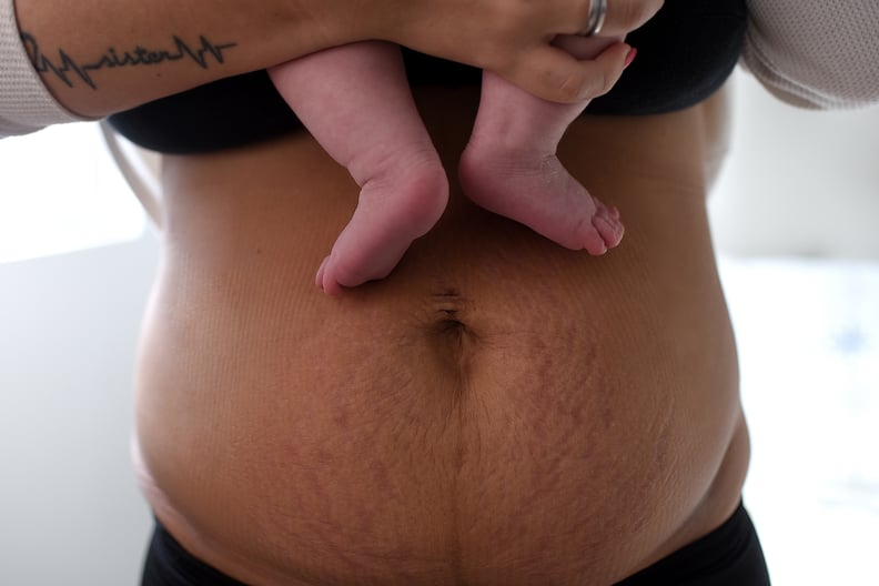 Belly binding after birth
