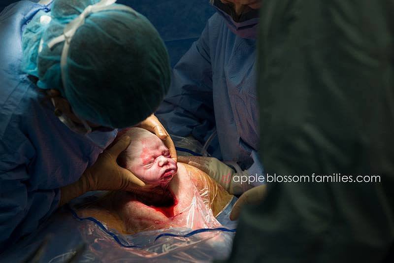 Intense Birth Photos