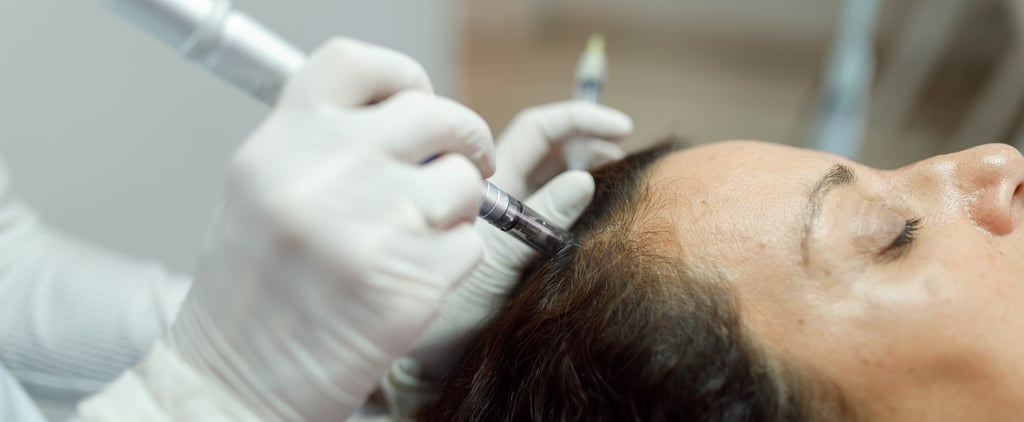 Scalp Microneedling: Cost, Benefits, and More