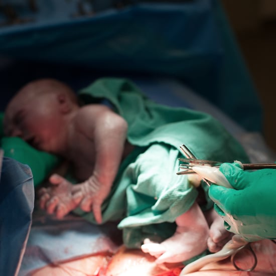 Delayed Umbilical Cord Clamping Could Have Benefits Later On