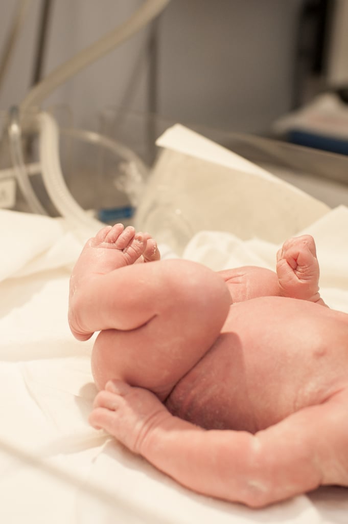 C-Section Birth Story Photo Shoot