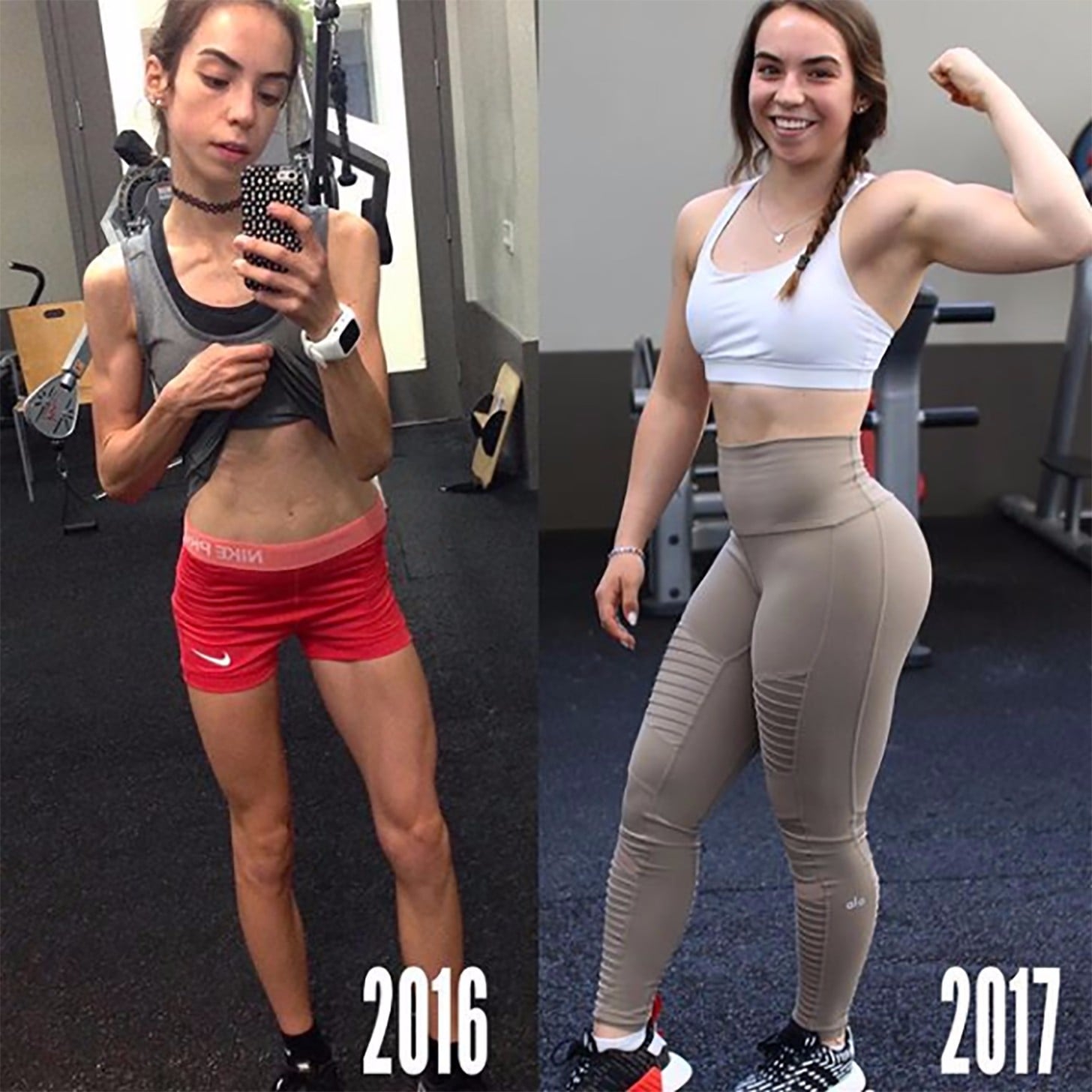 Before And After Weight Gain Telegraph