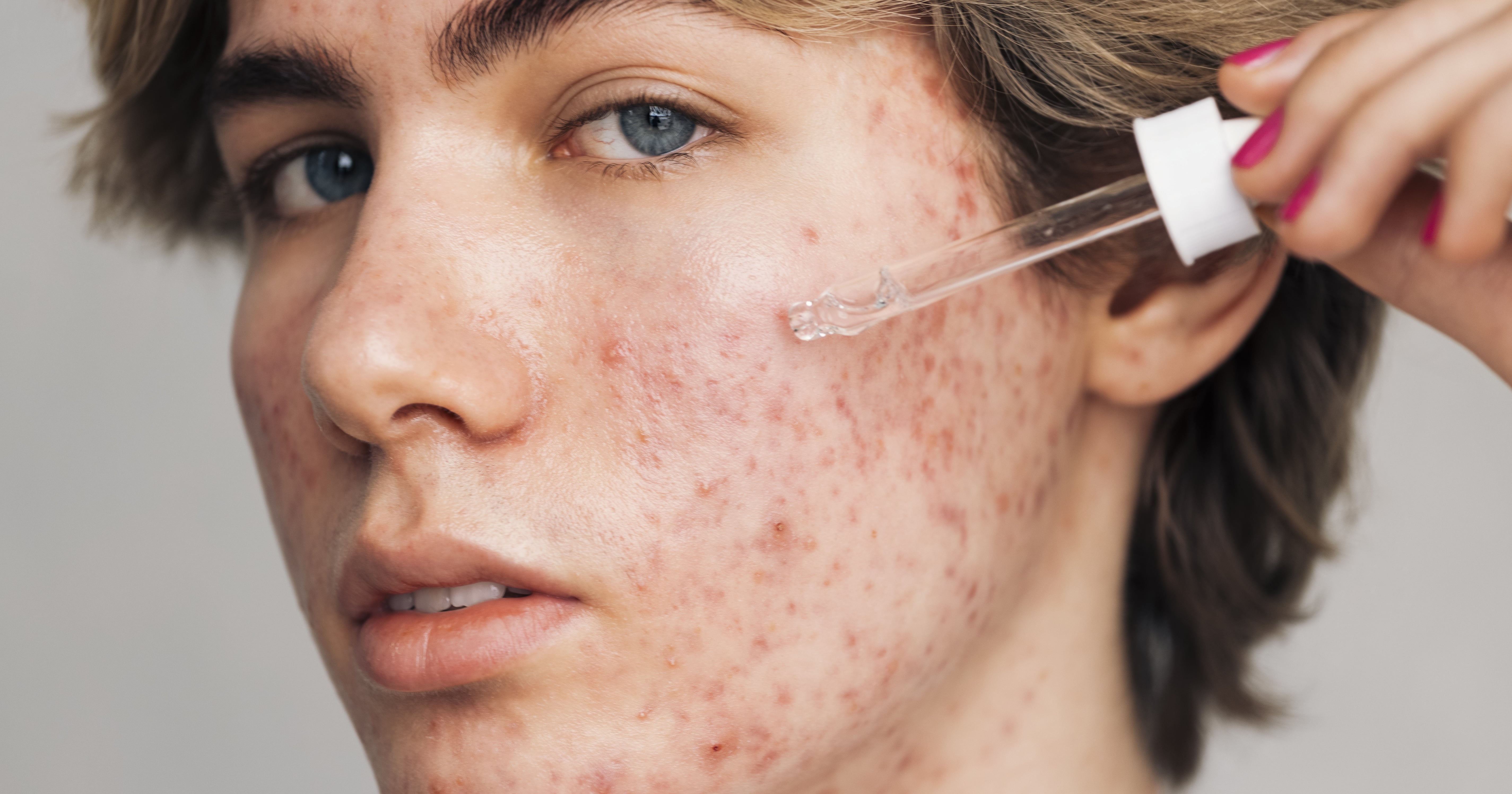 How to Unclog Pores, According to Doctors and Aestheticians
