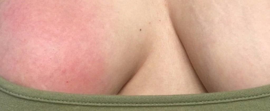 Does Breastfeeding Hurt?