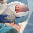 This Simple Technique Gives C-Section Babies All the Benefits of a Vaginal Delivery