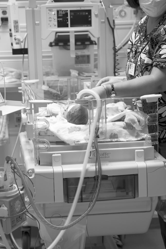 Trisomy 13 and 18 Baby Photos