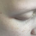 This Photo of a Little Girl's Last Eyelash as She Battles Cancer Will Break Your Heart