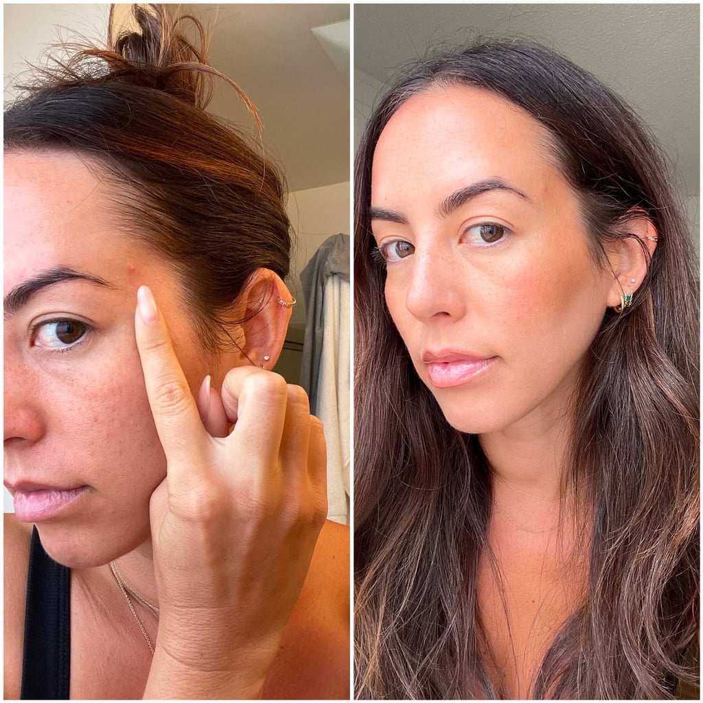 "Sandwich" Method to Cover Pimples
