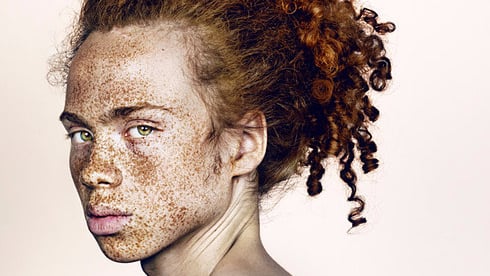 Photos of People With Freckles