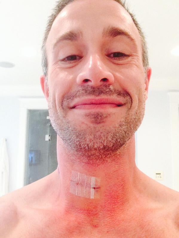 Freddie shared a postsurgery picture.