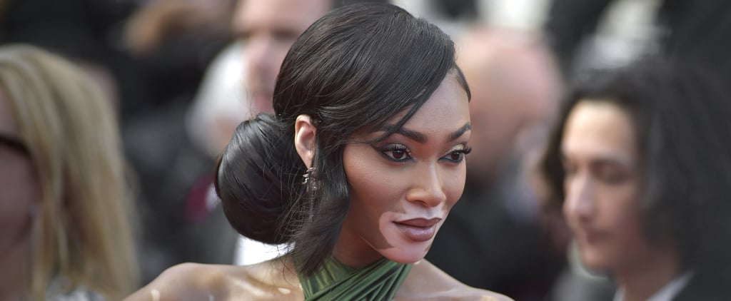 Winnie Harlow's New Tattoo Is Dedicated to Kyle Kuzma