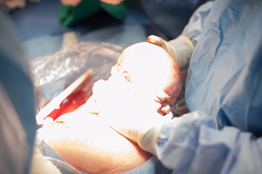 Photos of C-Sections