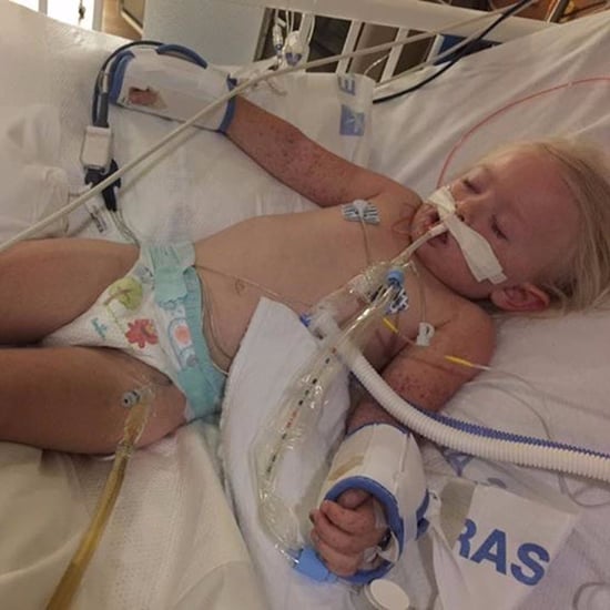 Toddler With Rocky Mountain Spotted Fever