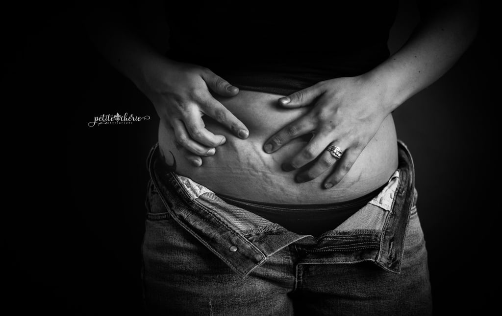 Related:

            
            
                                    
                            

            My Real Postpartum Body
