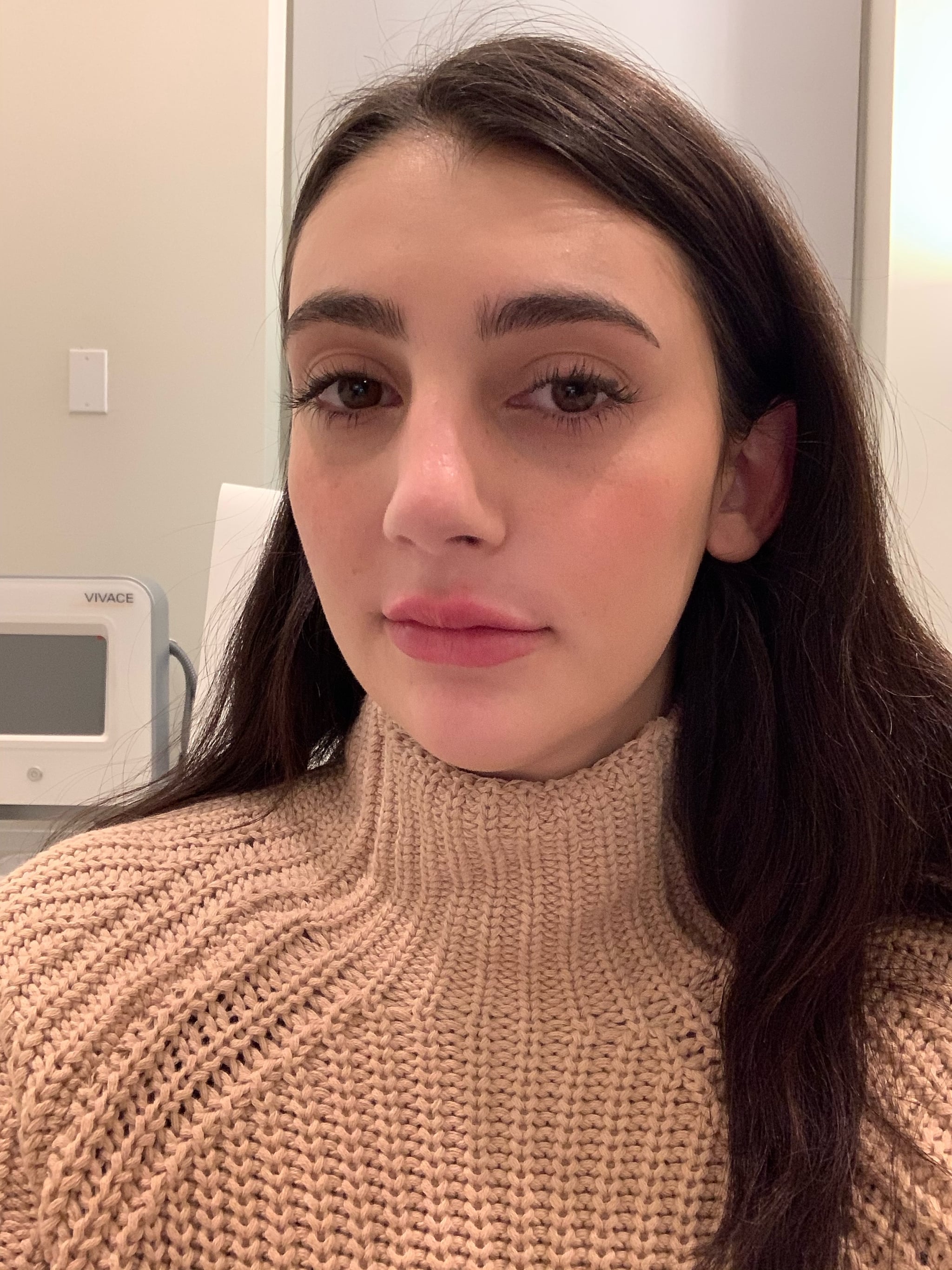What To Know Before Lip Filler Popsugar Beauty