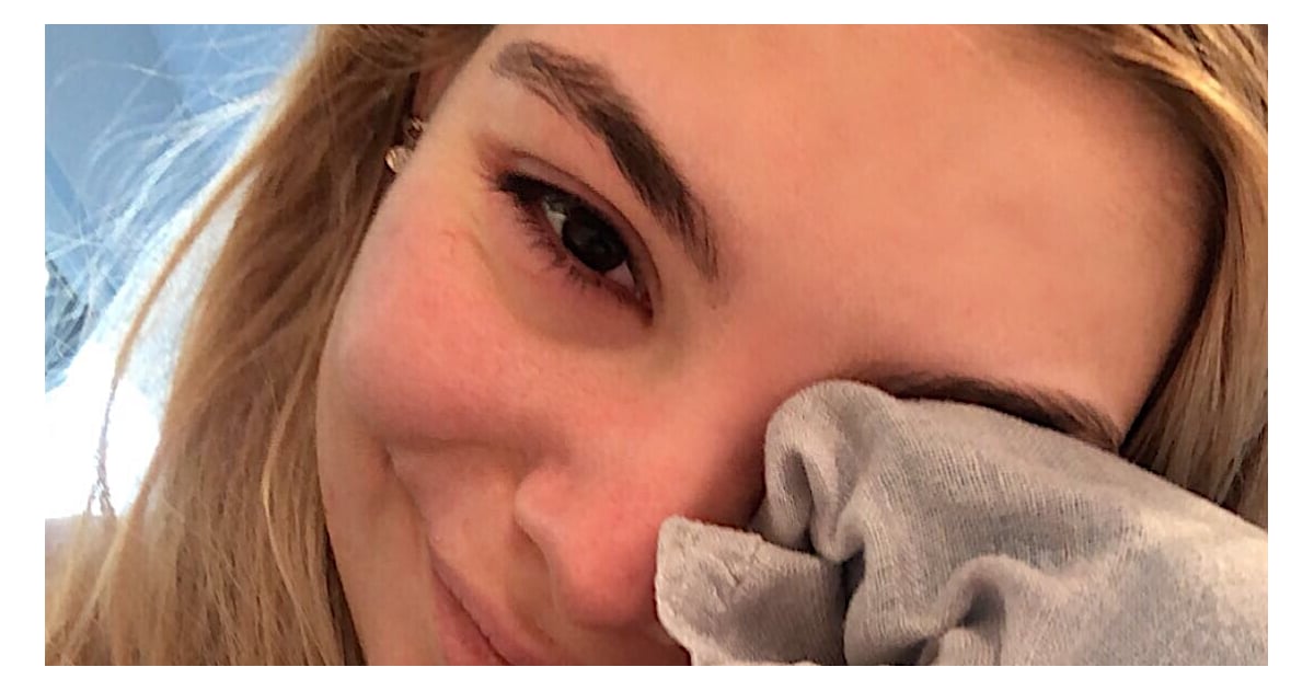 I Was Hospitalized After Getting an Eyelash Tint, and Here's What I Learned