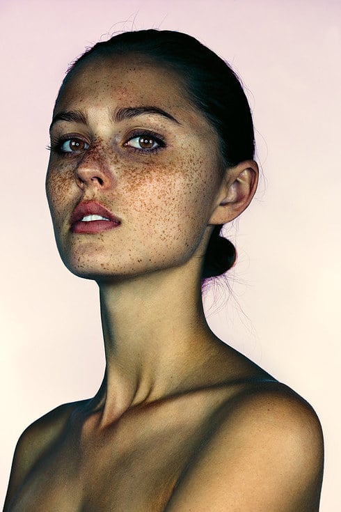 Photos of People With Freckles