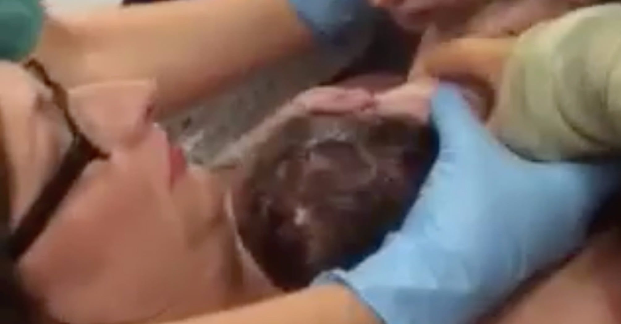 This Baby Basically Delivered Itself During A 'Natural' Cesarean Birth  That's Going Viral