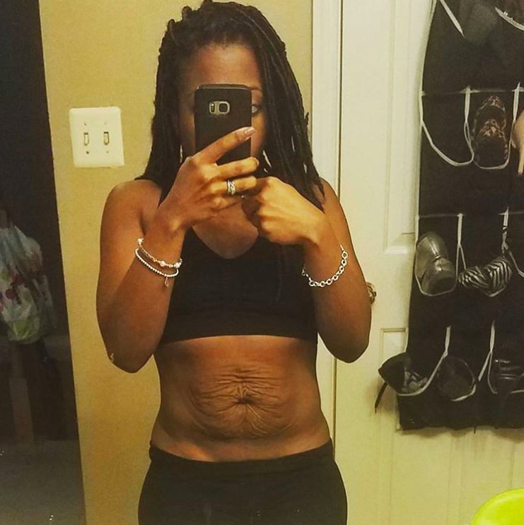 This fit mama said "enough" and decided she "will no longer be embarrassed by [her] loose skin" because she "can't compare your snap back to [her] snap back." — Brittanie