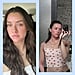 Skinfluencer Madeleine Edwards Doesn't Let Eczema Flare-Ups Run Her Life