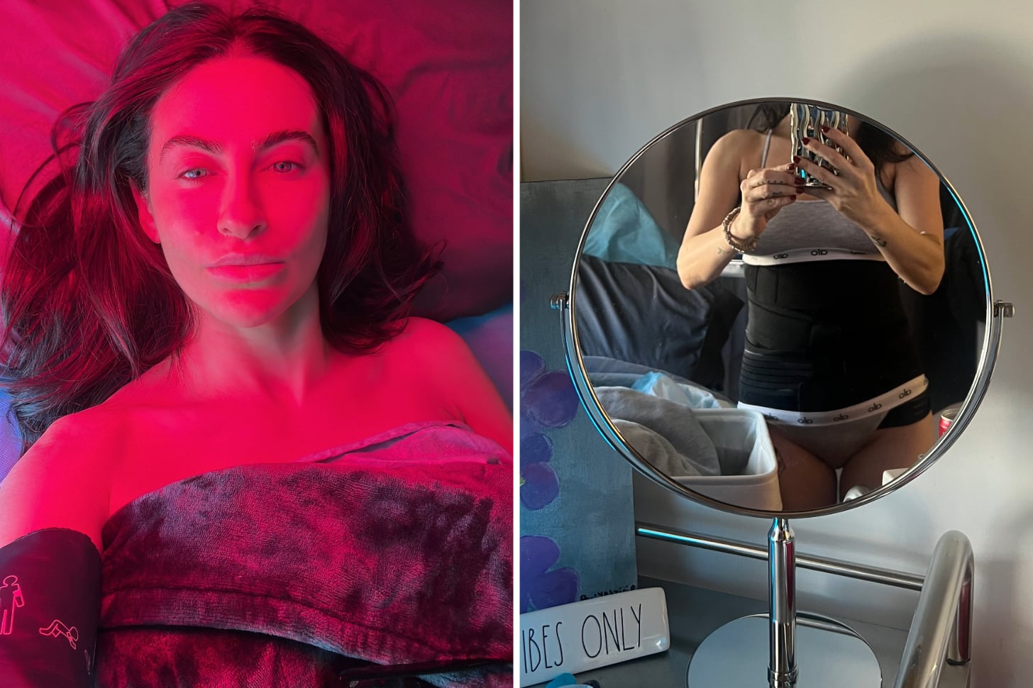 renuvion before and after and review