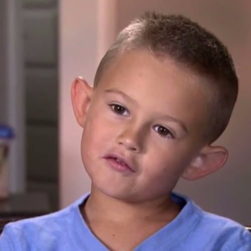 6-Year-Old Boy Gets Ear Surgery