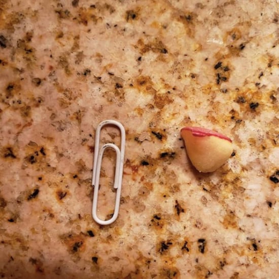 Mom Shares What Happened When Her Son Choked on an Apple