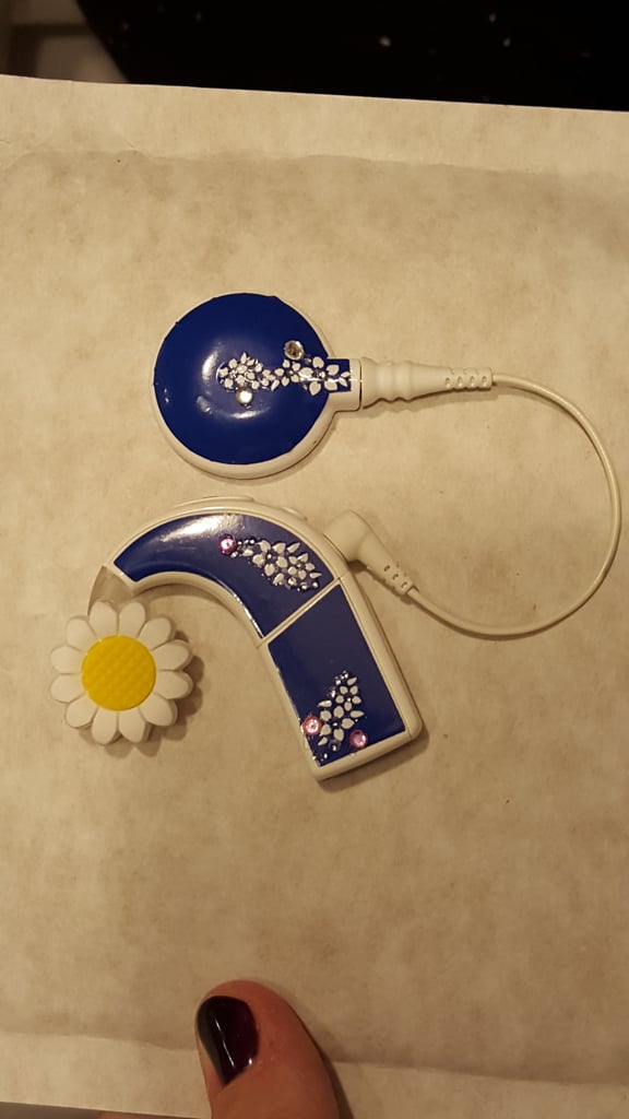 Mom Creates Superhero Hearing Aids For Son