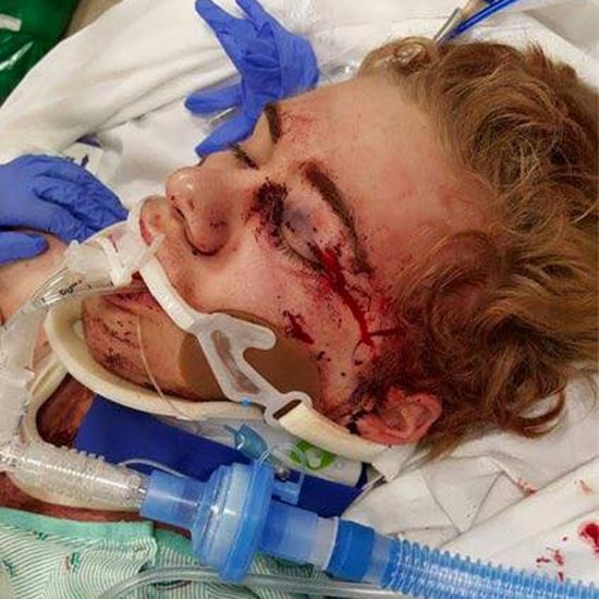Teen Hurt From Duct Tape Challenge